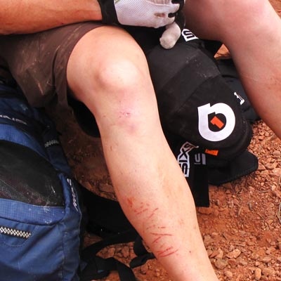 Offered great protection from those nasty cacti abrasions.