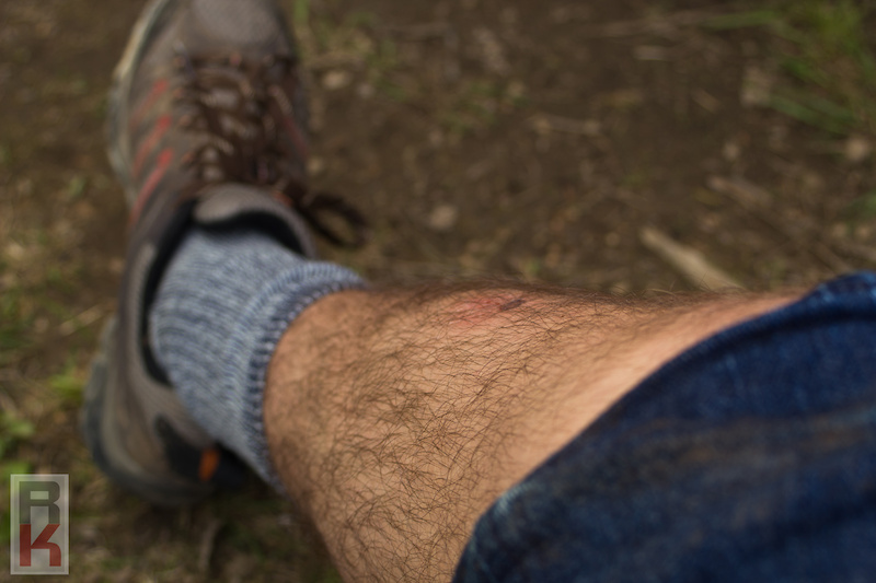 My leg after a collision with Nick Marvik!