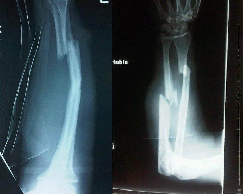 First ER x-rays