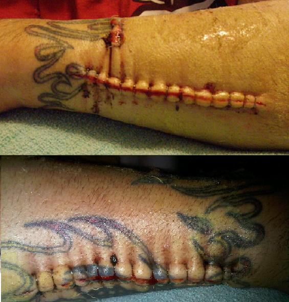 My post of surgery