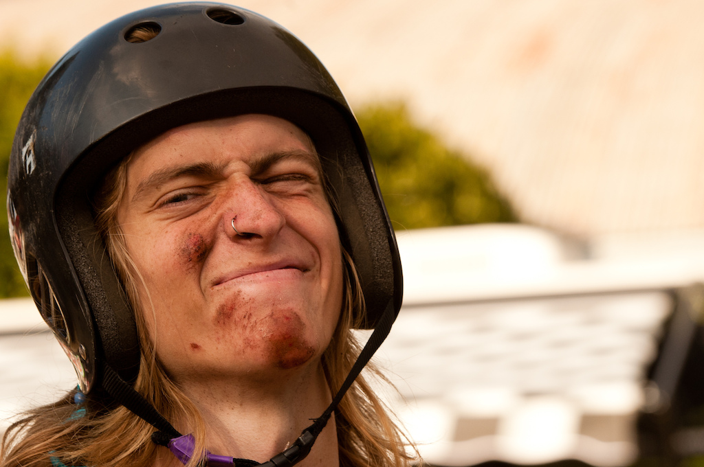 Unfortunately Cody also spent some time sliding on the ground with his face.